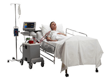 Dispositivo para diálisis podría remplazar ventilación mecánica Dispositivo para diálisis podría remplazar ventilación mecánica